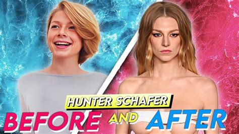 hunter schafer breast implant|Hunter Schafer’s Breast Implants Before And After